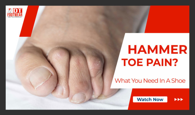 hammer toe shoe solution