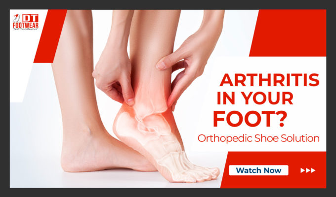 Arthritis in Foot Pain