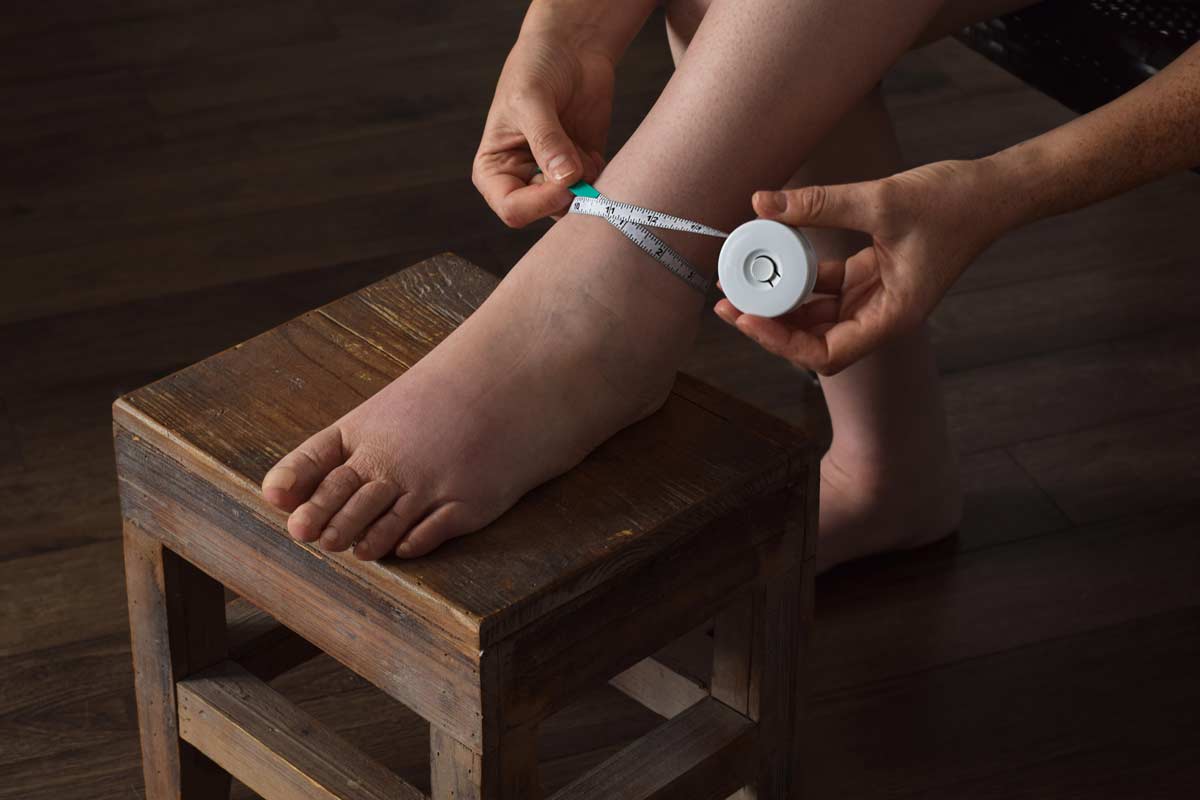 person measuring swollen ankle