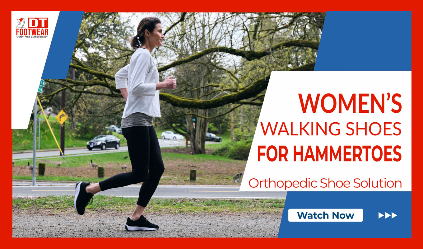 women with hammertoes jogging in park